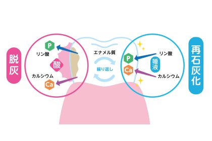 脱灰と再石灰化の説明図